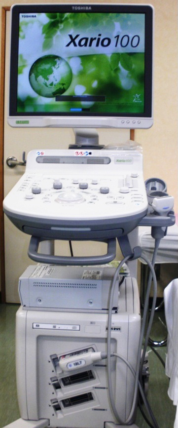 甲状腺の検査をするエコ－診断装置
